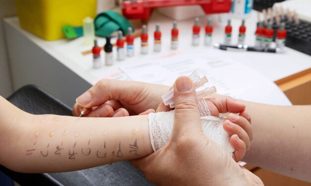 Clinical Challenges: Oral Immunotherapy for Food Allergies