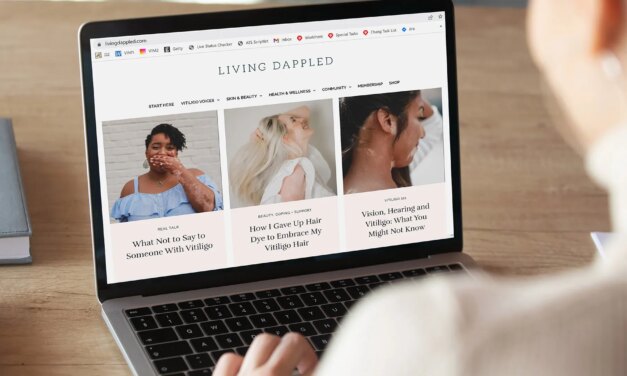 Vitiligo: Find Others Who Share Your Journey
