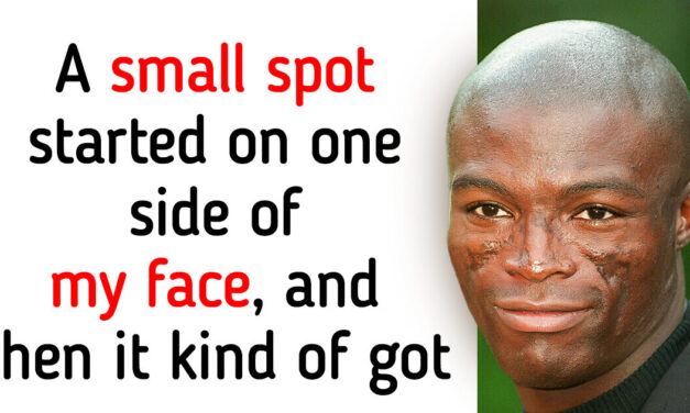 Seal Opens Up About «Traumatizing» Scars on His Face and What Caused Them