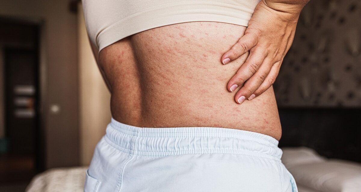 Why women are more prone to autoimmune diseases