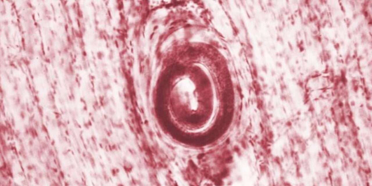 Parasitic worms infect 6 after bear meat served at family reunion