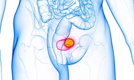 EMA Greenlights Four Drugs for Bladder and Other Cancers