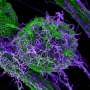 Study traces Ebola’s route to the skin surface