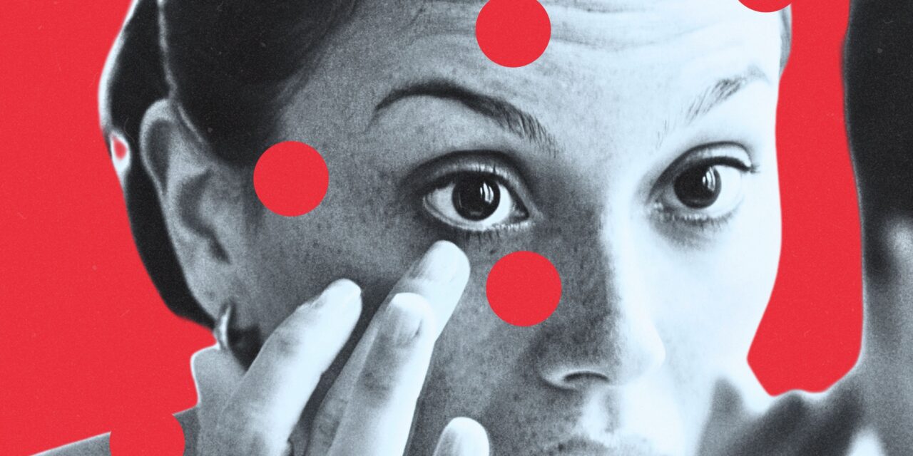 So You Lost Your Contact Lens in Your Eye. Here’s Exactly What to Do