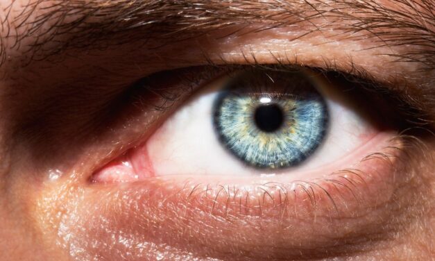 Doctors Can Spot Diabetes and Cancer in Your Eyes. Are You Missing the Signs?