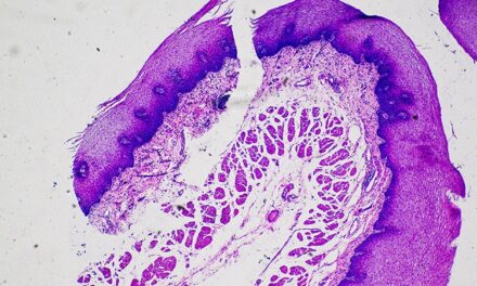 AI-Derived Risk Score May Improve Risk Stratification of Squamous Cell Carcinomas