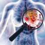 Low rates of isolated locoregional recurrence seen in young women with breast cancer