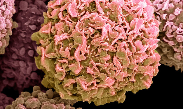 Trends in Global Cancer Cases, Deaths Offer Little Reassurance