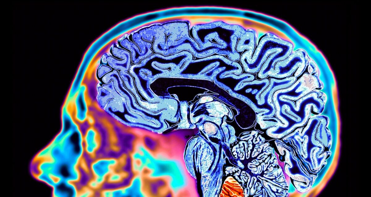Lithium plays a mysterious role in the brain. Could it be used to prevent Alzheimer’s?