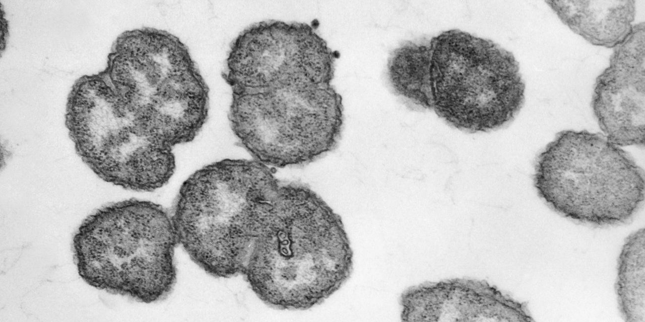 Diagnostic dilemma: A toddler accidently ate gonorrhea bacteria from a lab dish