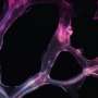 Novel AI tool offers prognosis for patients with head and neck cancer