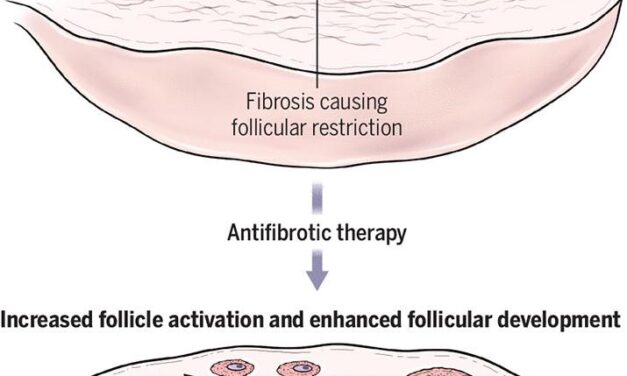 The ovarian stroma as a therapeutic target | Science