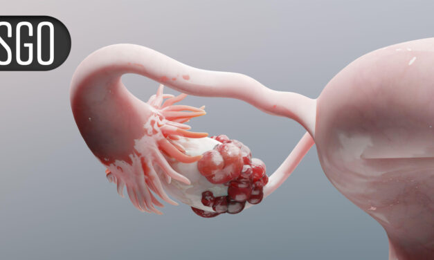 Novel Regimen Boosts Survival for Recurrent Platinum-Resistant Ovarian Cancer
