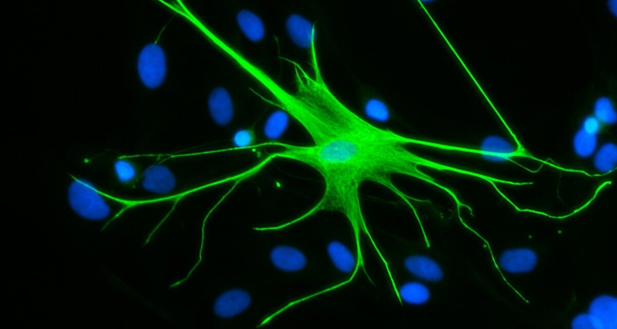 Are these overlooked brain cells the key to treating trauma and anxiety?