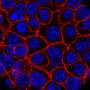 Adding a lower cutoff value for CA19-9 may identify additional high-risk cases of pancreatic cancer