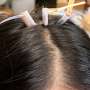 Thermoreversible biogel may solve a hairy problem for wearable brain-monitoring systems