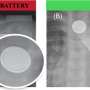 New button battery technology shows promise, but swallowing remains an emergency