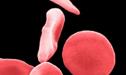 Scientists cured sickle cell. Then their next challenge began.