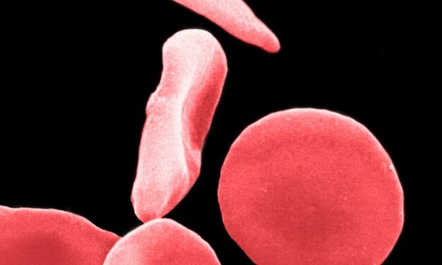 Scientists cured sickle cell. Then their next challenge began.