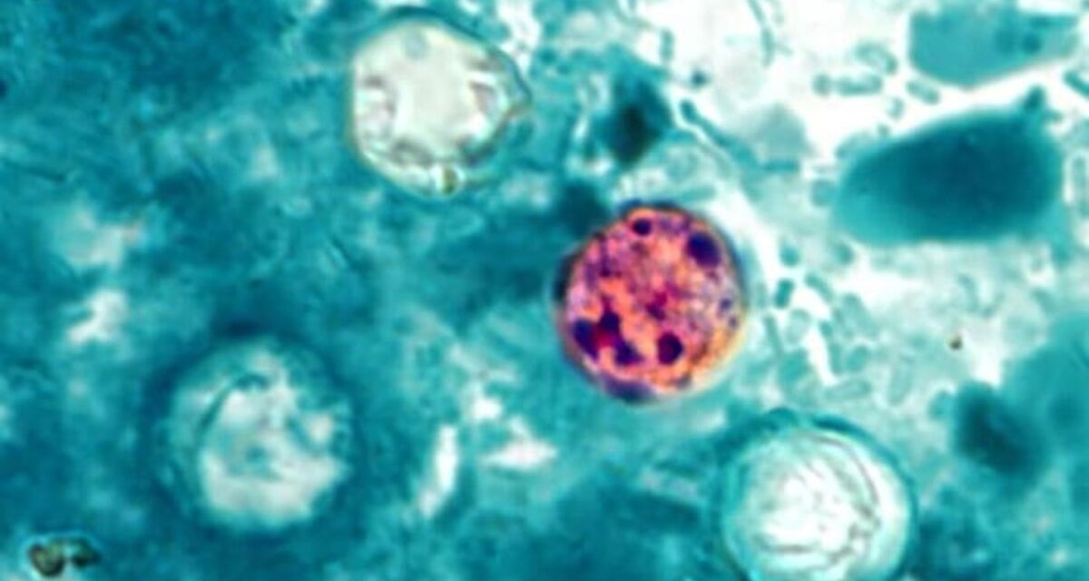 What is cyclospora? Here’s how the parasite spreads