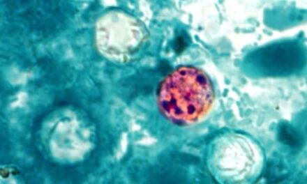 What is cyclospora? Here’s how the parasite spreads