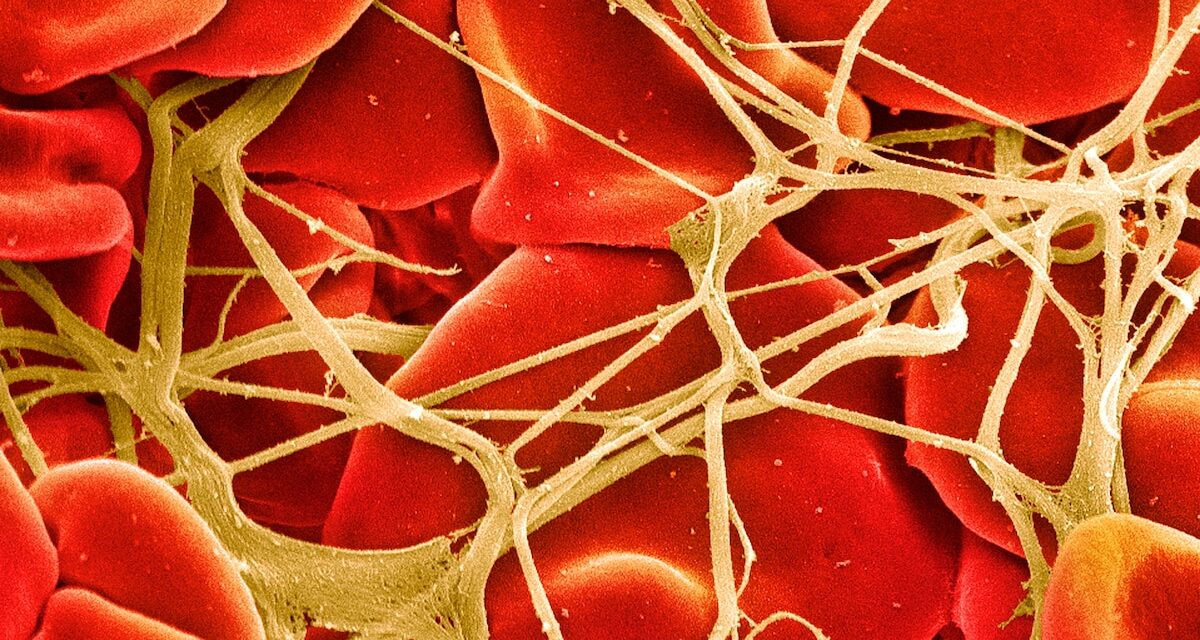 The Breakthrough Drugs Transforming Hemophilia Care
