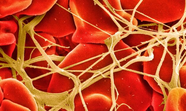 The Breakthrough Drugs Transforming Hemophilia Care