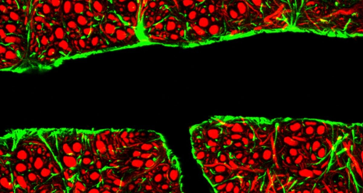 The Quest to Deliver Alzheimer’s Drugs Directly to the Brain