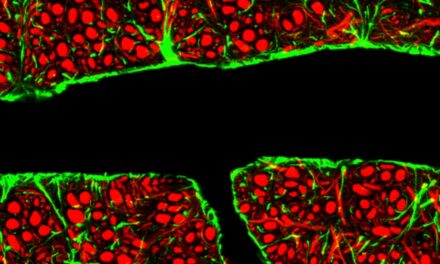 The Quest to Deliver Alzheimer’s Drugs Directly to the Brain